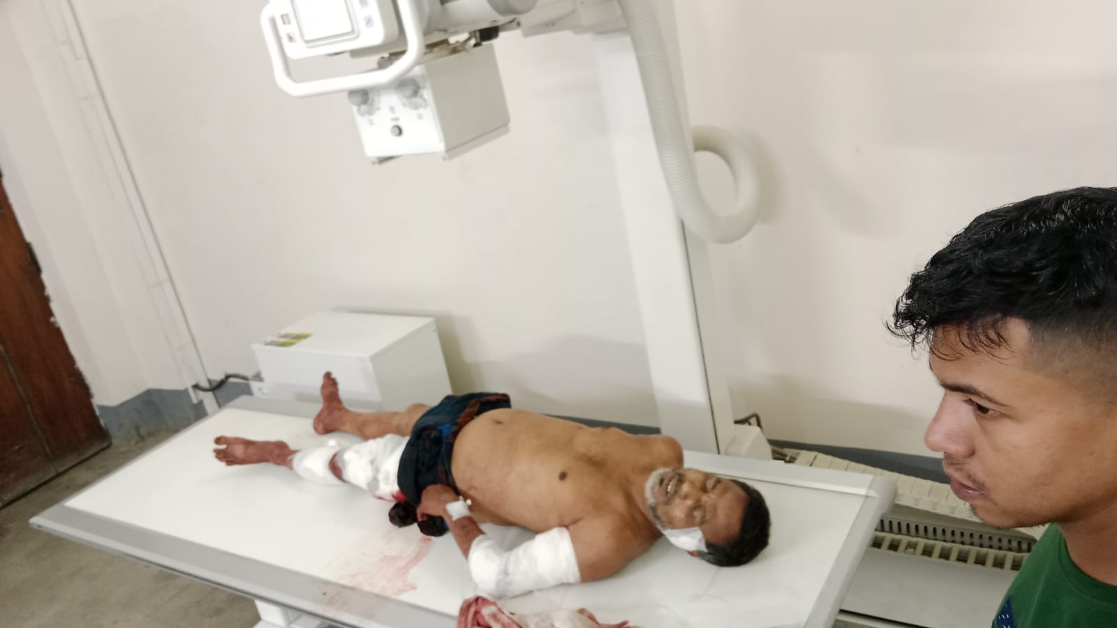 সিলেটে সন্ত্রাসী নাহিদের হামলায় মৃত্যু পথযাএী শওকত ওসমানীতে নগদ টাকা লুট